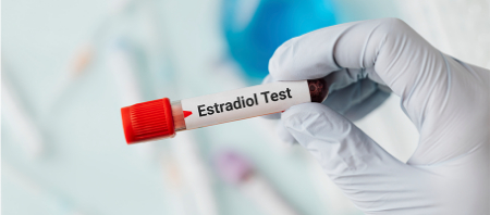 همه چیز در مورد آزمایش استرادیول (estradiol)