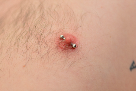 پیرسینگ نوک سینه, درد پیرسینگ نوک سینه