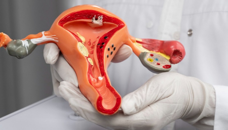 ترکیدن فیبروم رحم, عوارض فیبروم رحمی