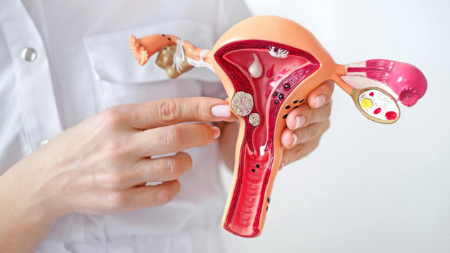 ترکیدن فیبروم رحم, عوارض فیبروم رحمی