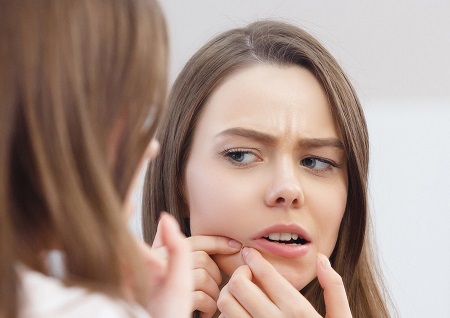 علل، پیشگیری و درمان جوش های گوارشی
