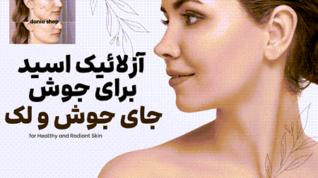 آزلائیک اسید؛ ترکیبی مؤثر برای جوش، جای جوش و لک