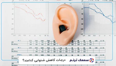 تکنولوژی‌های نوین در تجویز و تنظیم انواع سمعک‌های هوشمند