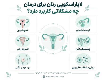 لاپاروسکوپی زنان برای درمان چه مشکلاتی کاربرد دارد