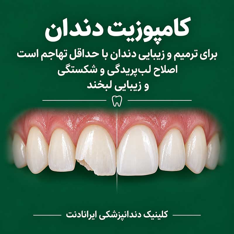 ایمپلنت، کامپوزیت یا لمینت، هر کدام برای چه مشکلی مناسب هستند؟